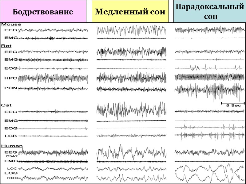 Бодрствование Медленный сон Парадоксальный  сон